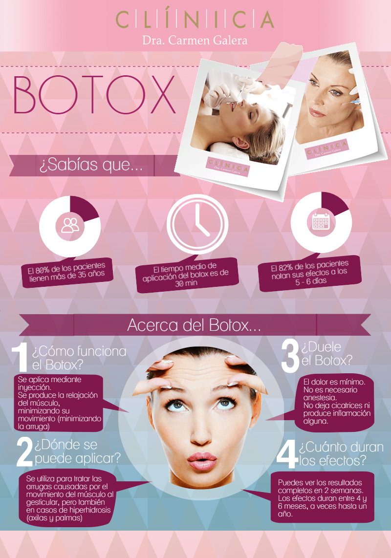 Infografía sobre el botox estético